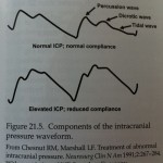 components of an icp wave form